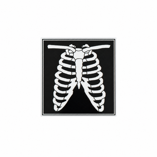 Chest X-Ray plastic add-on featuring a rib cage and chest radiograph design, compatible with interchangeable badge reel bases, radiology tech badge accessory