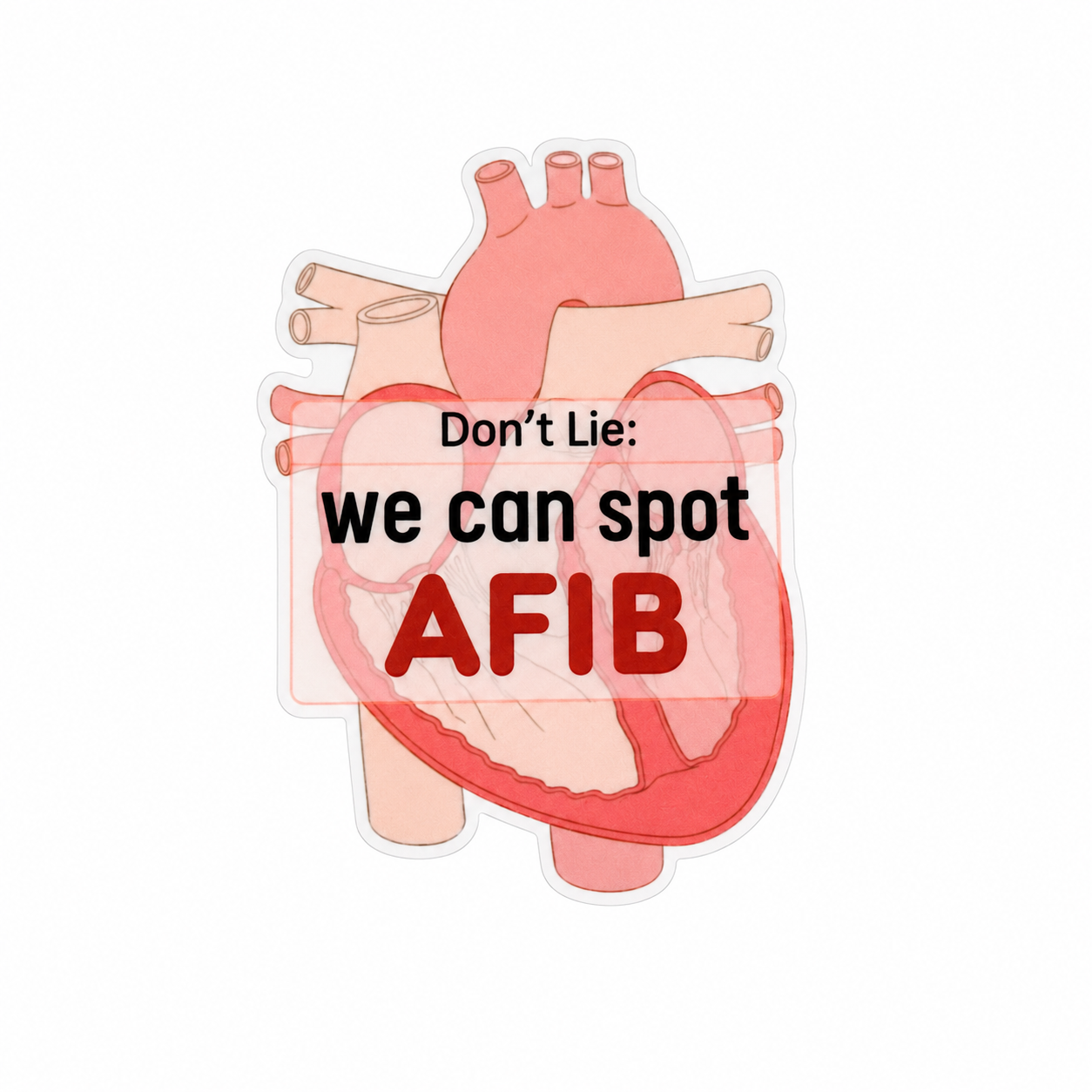Plastic add-on featuring the text "Don't Lie: we can spot AFIB" with an anatomical heart design, compatible with interchangeable badge reel bases and ideal for cardiology nurses.